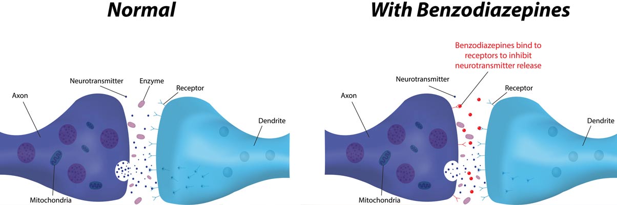 How Benzodiazepines Affect the Brain?